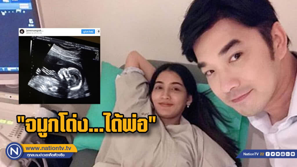 "เจมส์" เห่อสุดๆอวดภาพอัลตราซาวด์ลูกสาวบอกชัด "จมูกโด่ง...ได้พ่อ"