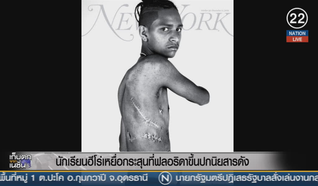 (คลิปข่าว) นักเรียนฮีโร่เหยื่อกระสุนฟลอริดา ขึ้่นปกนิตยสารดัง