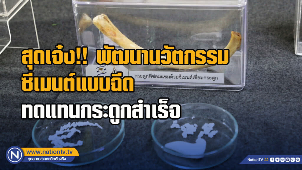 นักวิจัย มทส.สุดเจ๋ง!! พัฒนานวัตกรรมซีเมนต์แบบฉีด ทดแทนกระดูกสำเร็จ นักวิจัย มทส.สุดเจ๋ง!! พัฒนานวัตกรรมซีเมนต์แบบฉีด ทดแทนกระดูกสำเร็จ