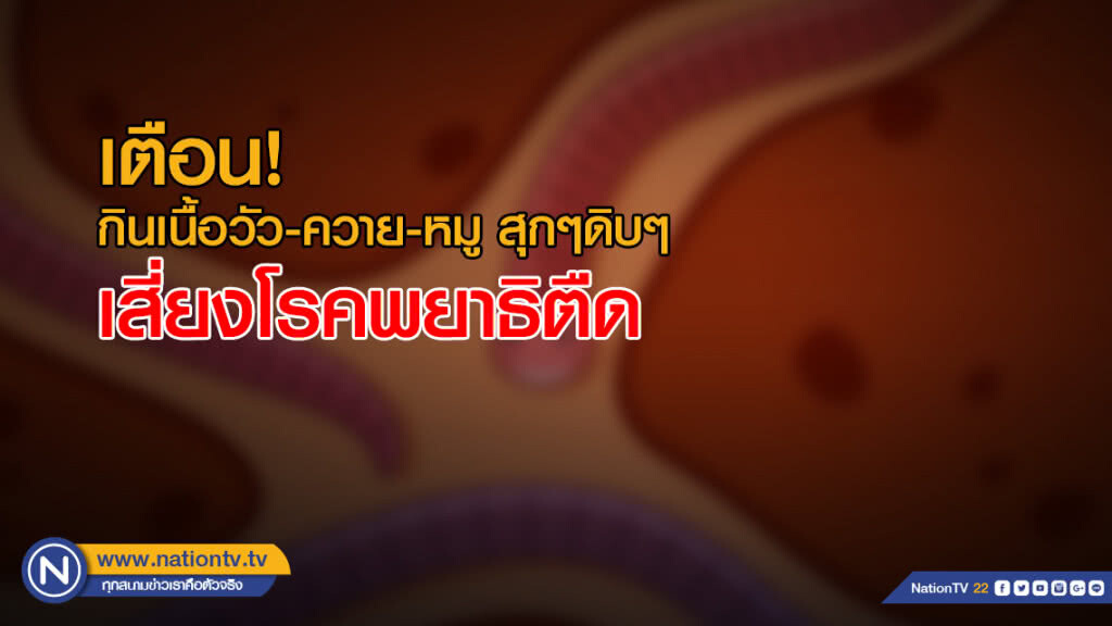 สธ.เตือนประชาชน กินเนื้อวัว-ควาย-หมู สุกๆดิบๆ เสี่ยงโรคพยาธิตืด