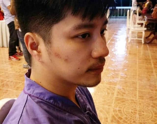 "ตี๋ วิวิศน์" ปลอดภัยแล้ว!!! หลังตกเวทีขณะแสดง