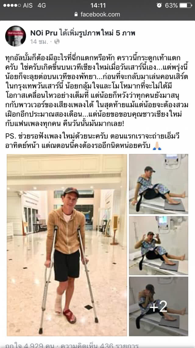 "น้อย วงพรู" ใส่ลีลาบนเวทีแบบจัดเต็ม จนกระดูกเท้าแตก!!!