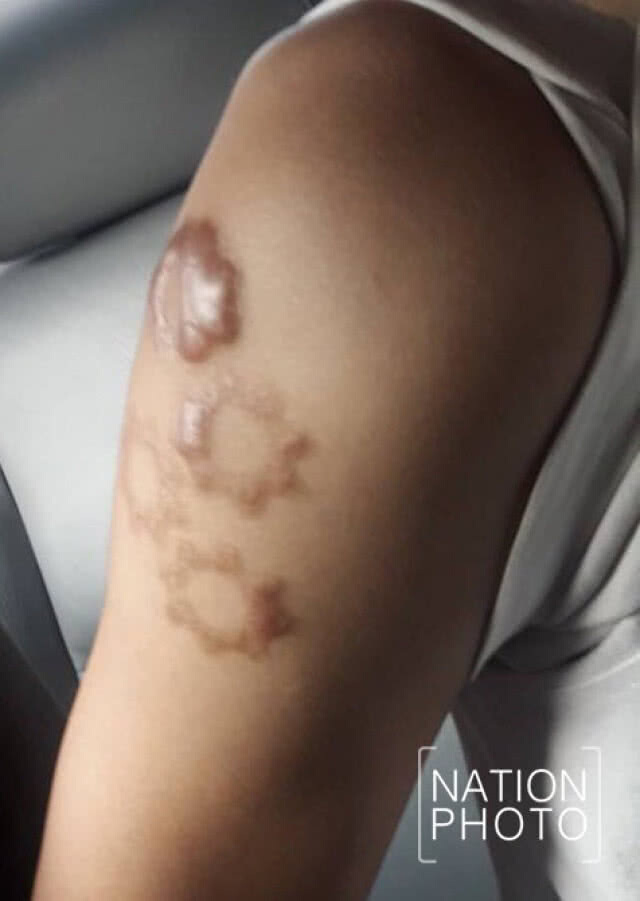 น1.ยืนยันจับแล้ว 3 แก๊งมือยิงน.ศ.อุเทนฯ