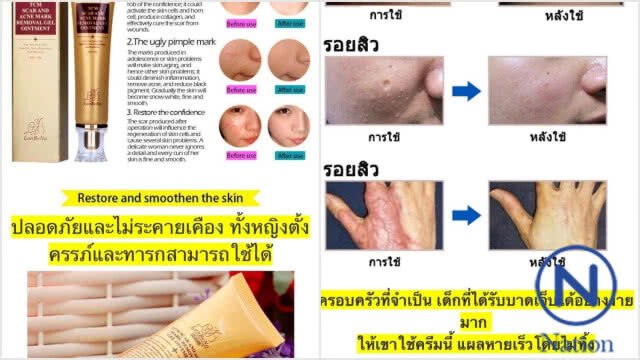 แจ้งความร้านครีมออนไลน์นำภาพทางการแพทย์ไปตัดต่อชวนเชื่อ