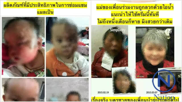 แจ้งความร้านครีมออนไลน์นำภาพทางการแพทย์ไปตัดต่อชวนเชื่อ