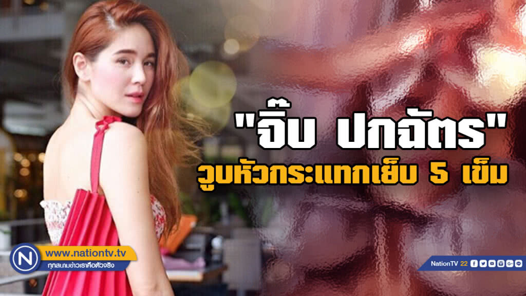 เย็บด่วน! "จิ๊บ ปกฉัตร" วูบ หวิดเสียโฉม เย็บด่วน! "จิ๊บ ปกฉัตร" วูบ หวิดเสียโฉม