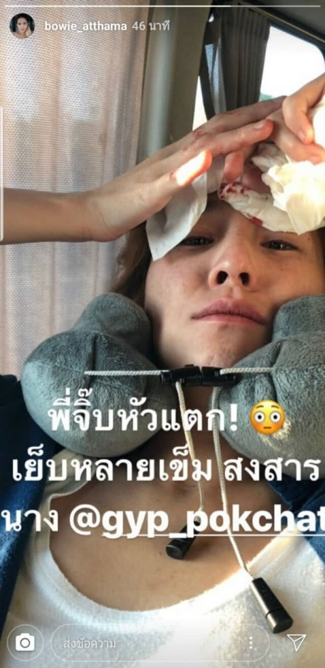 หาม"จิ๊บ" ปกฉัตร' ส่งรพ. วูบกลางสนามสนามบิน เย็บ 7 เข็ม