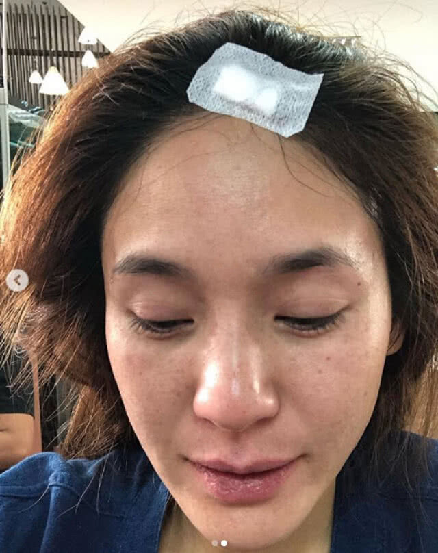 หาม"จิ๊บ" ปกฉัตร' ส่งรพ. วูบกลางสนามสนามบิน เย็บ 7 เข็ม