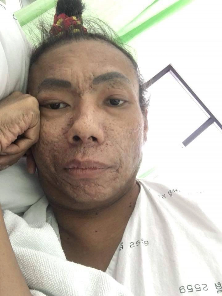 อาลัย "ไข่มุก ซุปตาร์" ดาวตลกดัง