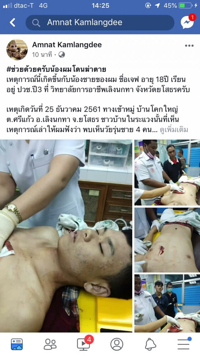 โพสต์เฟสบุ๊กขอความเป็นธรรม น้องชายถูกวัยรุ่นคู่อริหมู่บ้านใกล้เคียงแทงดับ ตร.ไม่นำตัวสอบปากคำ