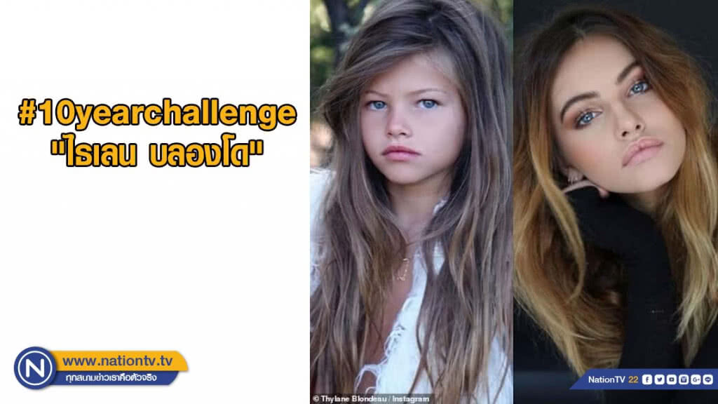 อึ้ง! นางแบบหน้าสวยที่สุดในโลกโพสต์รูปวัยเด็ก