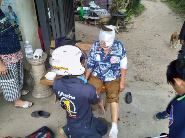 สุนัขพิทบูลกัดเจ้าของหลังหกล้ม