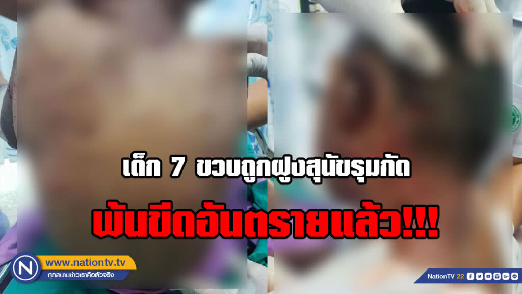 เปิดใจ! เพื่อนเด็ก 7 ขวบ ผู้เห็นนาทีถูกฝูงสุนัขรุมขย้ำ