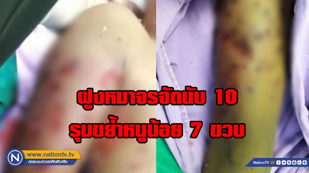 สุดโหด!!! ฝูงหมาจรจัดนับ 10 รุมขย้ำหนูน้อย 7 ขวบ แผลทั้งตัว สุดโหด!!! ฝูงหมาจรจัดนับ 10 รุมขย้ำหนูน้อย 7 ขวบ แผลทั้งตัว