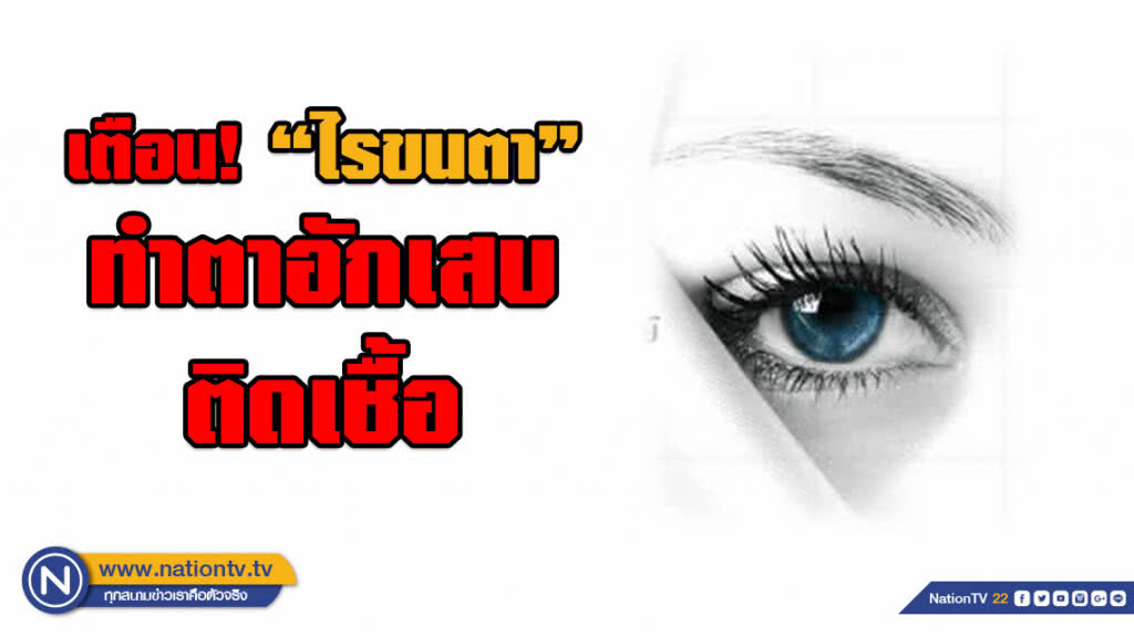 จักษุแพทย์ เตือน! ไรขนตา ทำตาอักเสบ ติดเชื้อ