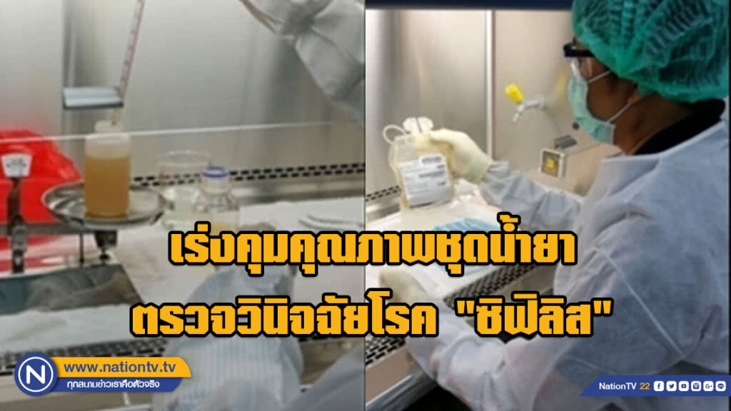 กรมวิทย์ฯ เร่งคุมคุณภาพชุดน้ำยาตรวจวินิจฉัยโรค "ซิฟิลิส"