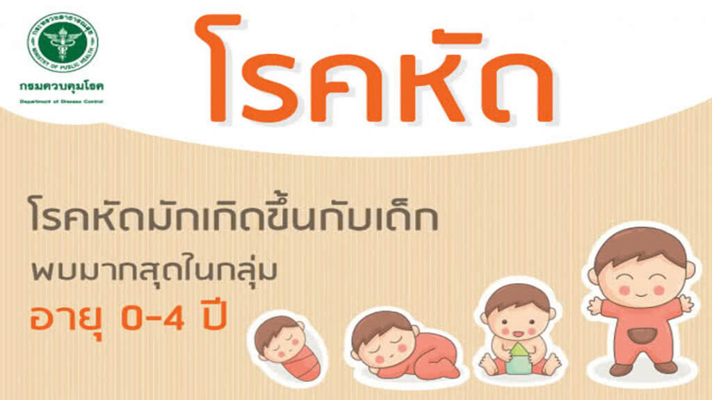 กรมควบคุมโรค ติดตามสถานการณ์โรคหัดในพื้นที่ภาคใต้ตอนล่างอย่างใกล้ชิด