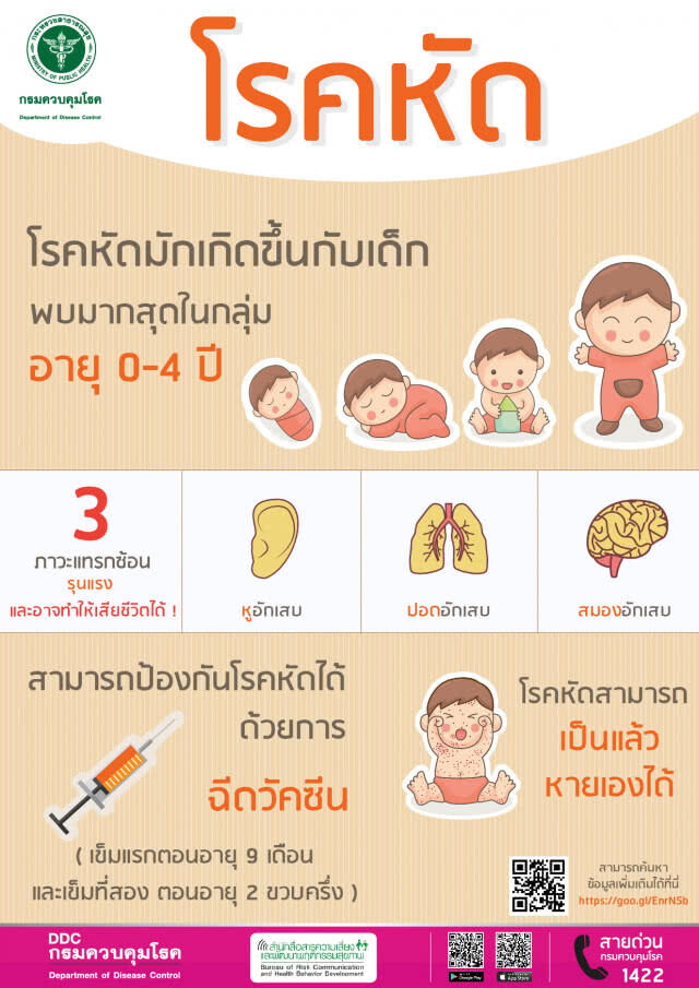 กรมควบคุมโรค ติดตามสถานการณ์โรคหัดในพื้นที่ภาคใต้ตอนล่างอย่างใกล้ชิด