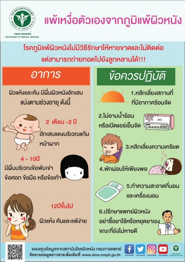 แพทย์แนะวิธีดูแล "อาการแพ้เหงื่อตัวเอง" จากภูมิแพ้ผิวหนัง