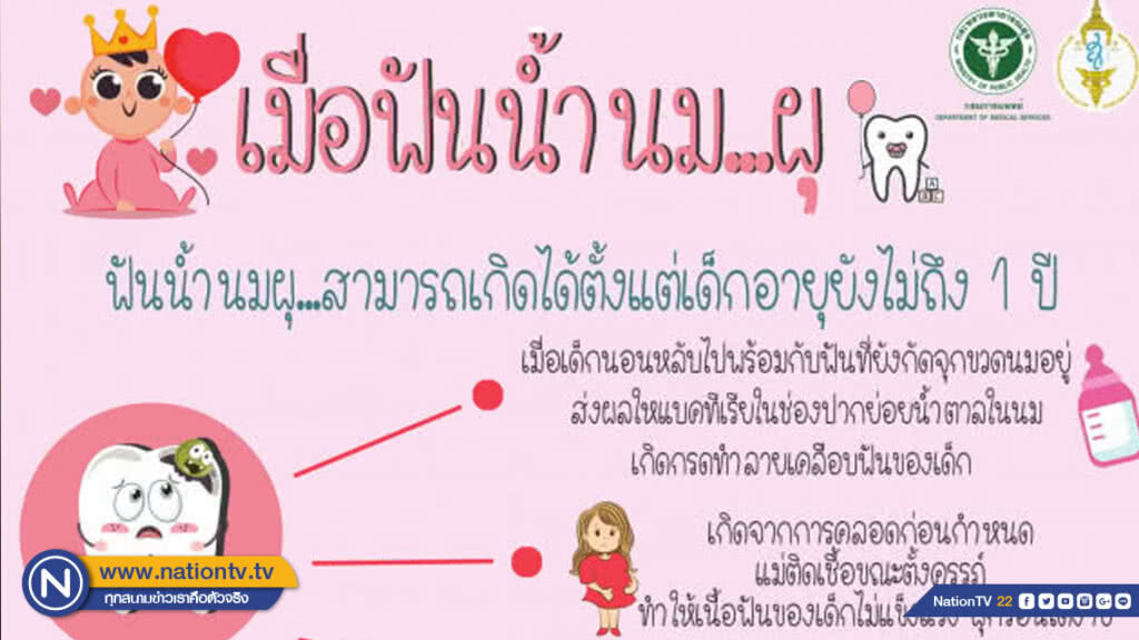 แพทย์แนะพ่อแม่ดูแลฟันน้ำนมลูก อย่าให้เสียไปก่อนวัยอันควร