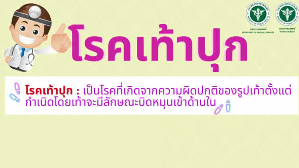 สธ.เตือน! หากพบลูกมีรูปเท้าผิดปกติ ควรรีบรักษาอย่าปล่อยทิ้งไว้ อาจเดินผิดปกติ
