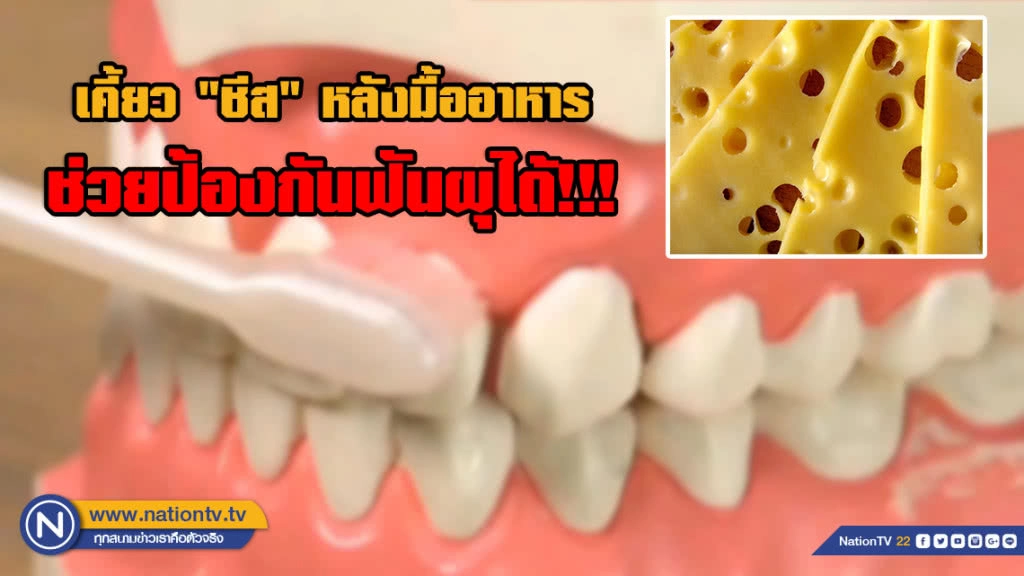 หมอฟันญี่ปุ่นเผย เคี้ยว "ชีส" หลังมื้ออาหาร ช่วยป้องกันฟันผุได้!!!