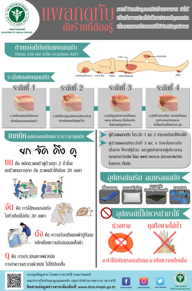 แนะผู้ป่วยติดเตียงขยับทุก​ 2​ ชั่วโมง​ ลดการเกิดแผลกดทับ