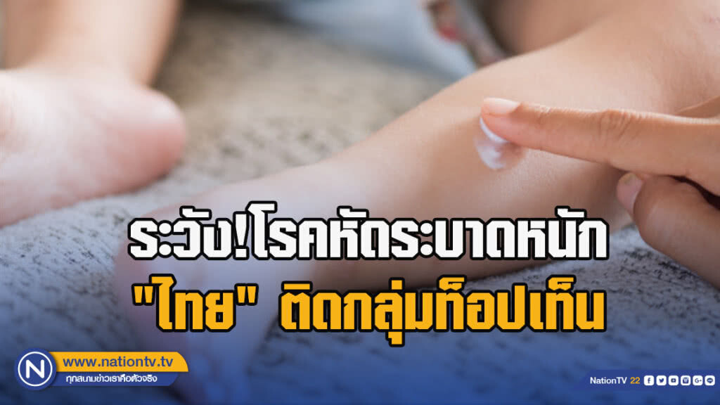ระวัง!โรคหัดระบาดหนัก"ไทย"ติดกลุ่มท็อปเท็น