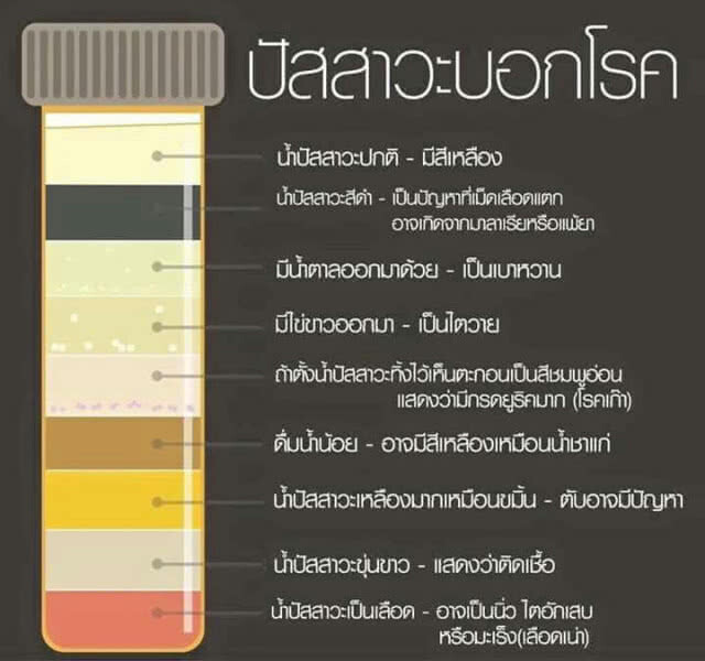 "สีปัสสาวะ" บอกสุขภาพร่างกายคุณได้