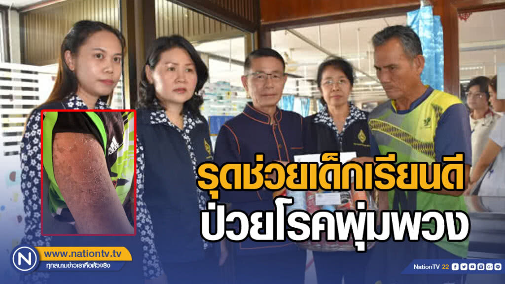 รุดช่วยเด็กเรียนดี ป่วยโรคพุ่มพวง