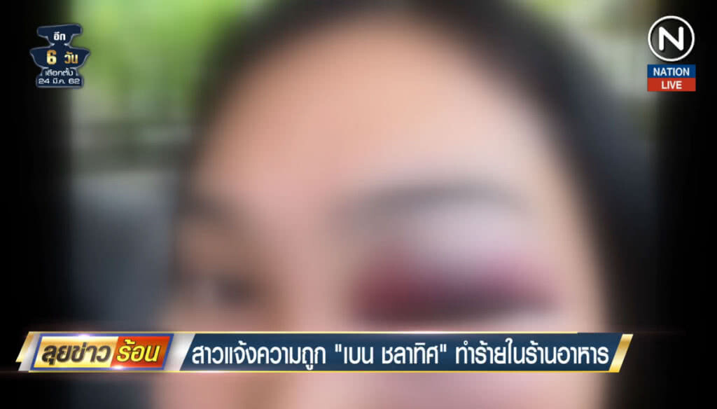 (คลิปข่าว) สาวแจ้งความถูก "เบน ชลาทิศ" ทำร้ายในร้านอาหาร