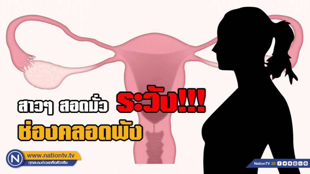 หมอจิ๋ม เตือน! สาวๆสอดมั่ว ระวังช่องคลอดพัง !! หมอจิ๋ม เตือน! สาวๆสอดมั่ว ระวังช่องคลอดพัง !!