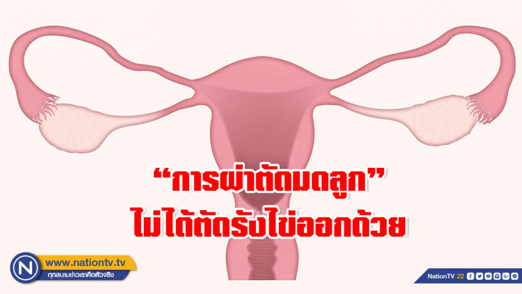 อย่าเข้าใจผิด!!! การผ่าตัดมดลูก ไม่ได้หมายความรวมถึงการตัดรังไข่ออกด้วย