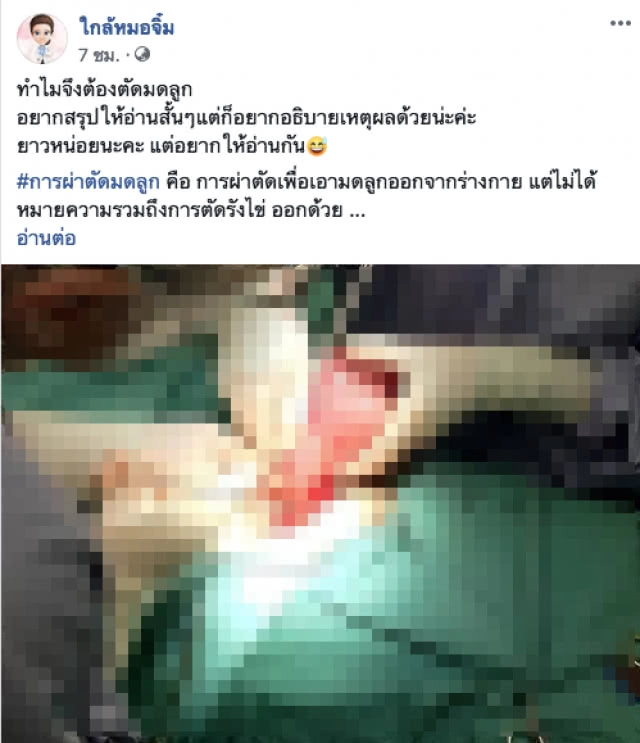 อย่าเข้าใจผิด!!! การผ่าตัดมดลูก ไม่ได้หมายความรวมถึงการตัดรังไข่ออกด้วย