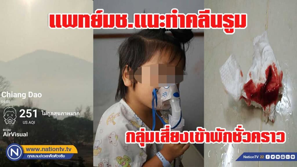 แพทย์มช.แนะทำคลีนรูมรับกลุ่มเสี่ยงพักชั่วคราวหนีฝุ่นพิษ
