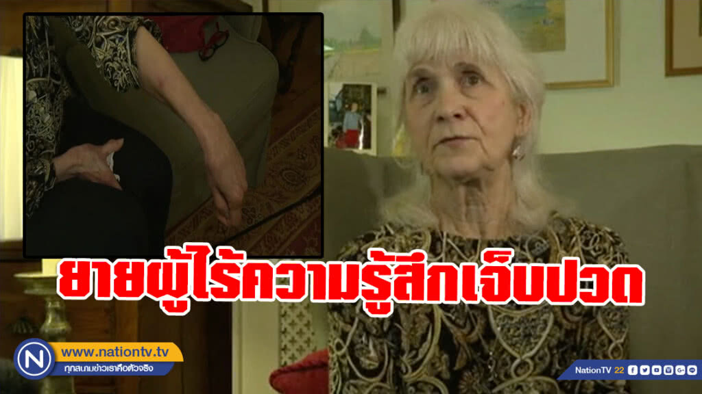 คุณยายชาวอังกฤษสุด พิเศษ? ไร้ความรู้สึกเจ็บปวด