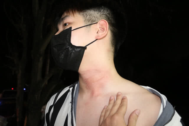 การไฟฟ้าจัดเก็บสายเคเบิ้ล ร่วงมาเกี่ยวคอนศ.บาดเจ็บ