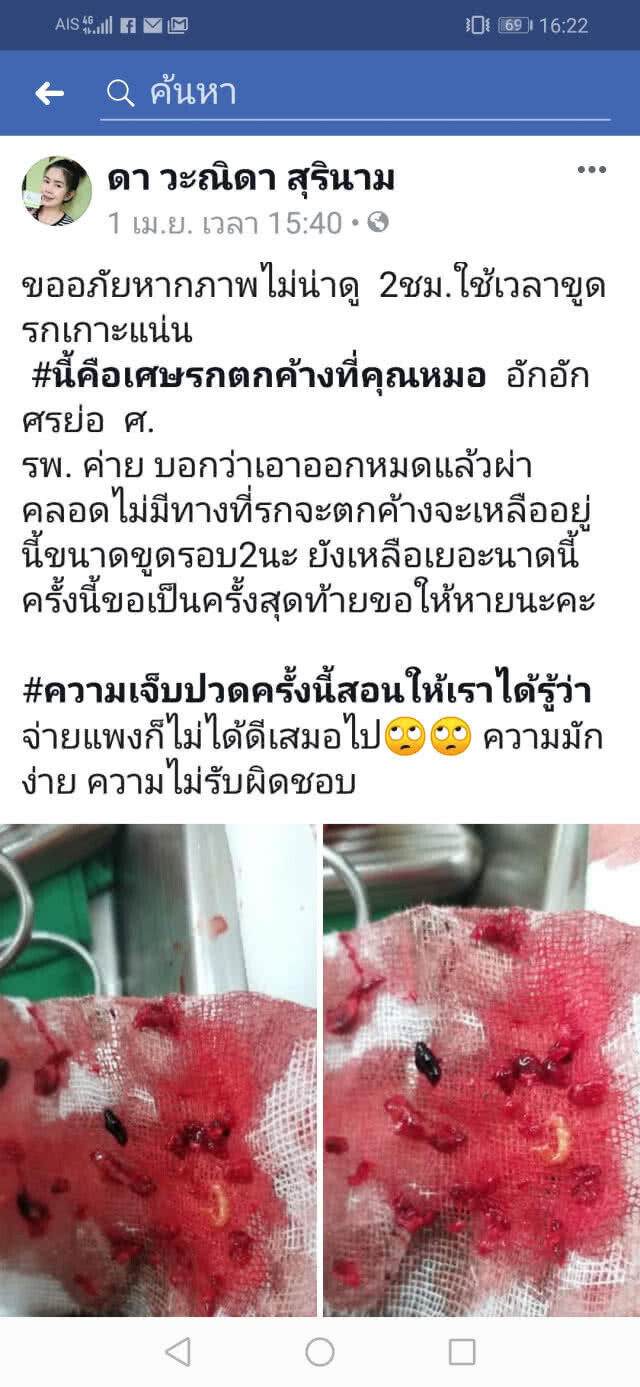 สาวเจ็บใจ!!คลอดพิเศษแต่หมอทำรกค้าง