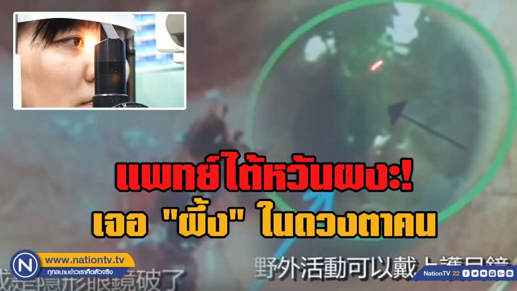 แพทย์ไต้หวันผงะ! เจอ"ผึ้ง"ในดวงตาคน