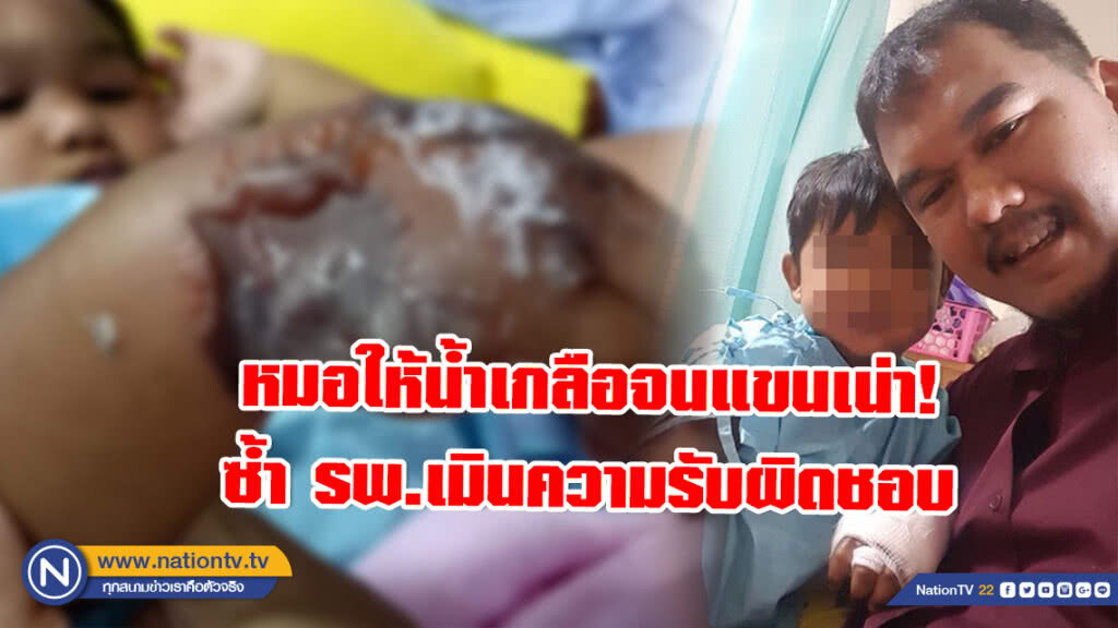 พ่อโอดลงโซเชียล! หมอรพ.ดัง ให้น้ำเกลือลูกชายพลาดจนแขนเริ่มเน่า ซ้ำเมินความรับผิดชอบ