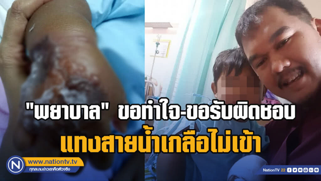 รพ.แถลงปม แทงสายน้ำเกลือไม่เข้าทำเด็กมือบวม รับรักษาจนกว่าจะหาย"พยาบาล"รับผิดชอบแล้ว