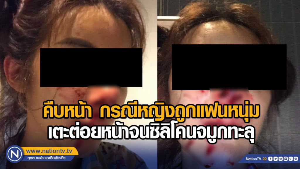 คืบหน้า กรณีหญิงถูกแฟนหนุ่มเตะต่อยหน้าจนซิลิโคนจมูกทะลุ คืบหน้า กรณีหญิงถูกแฟนหนุ่มเตะต่อยหน้าจนซิลิโคนจมูกทะลุ