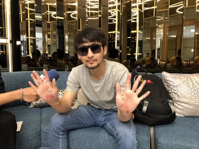 เปิดใจ หนุ่มถูกฉกนาฬิกาหรู 5 ล้านบาท รับเป็นความประมาท