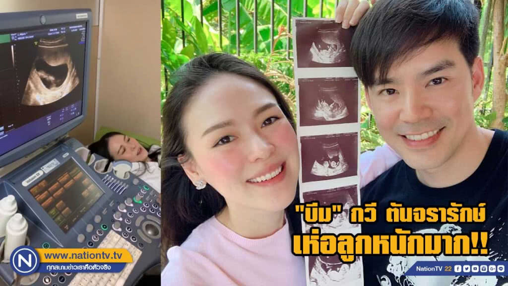 เห่อลูกหนักมาก!! 'บีม' ตื่นเต้นจะได้เป็นคุณพ่อแล้ว