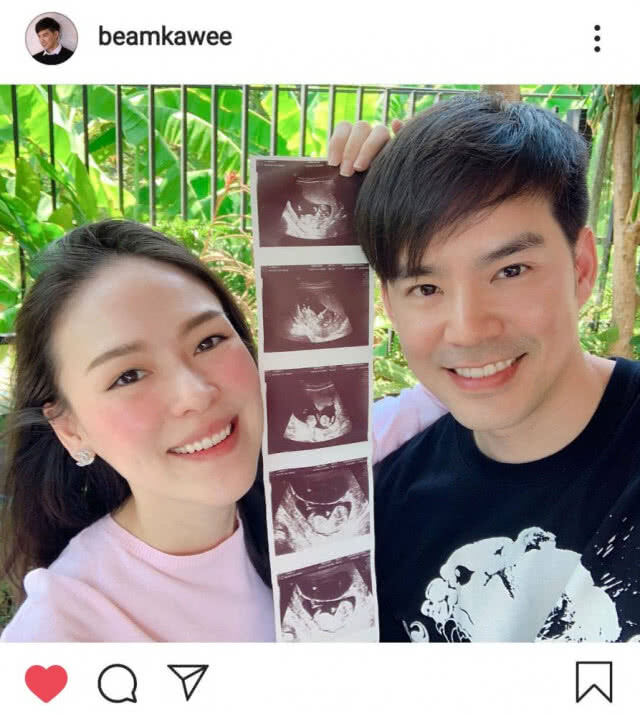 เห่อลูกหนักมาก!! 'บีม' ตื่นเต้นจะได้เป็นคุณพ่อแล้ว