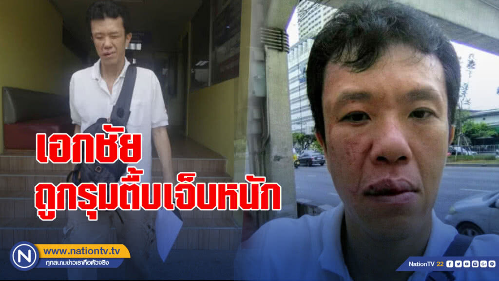 โดนอีก "เอกชัย" นักเคลื่อนไหว ถูกรุมตื้บเจ็บหนัก