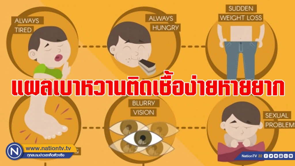 แผลเบาหวานติดเชื้อง่ายหายยาก