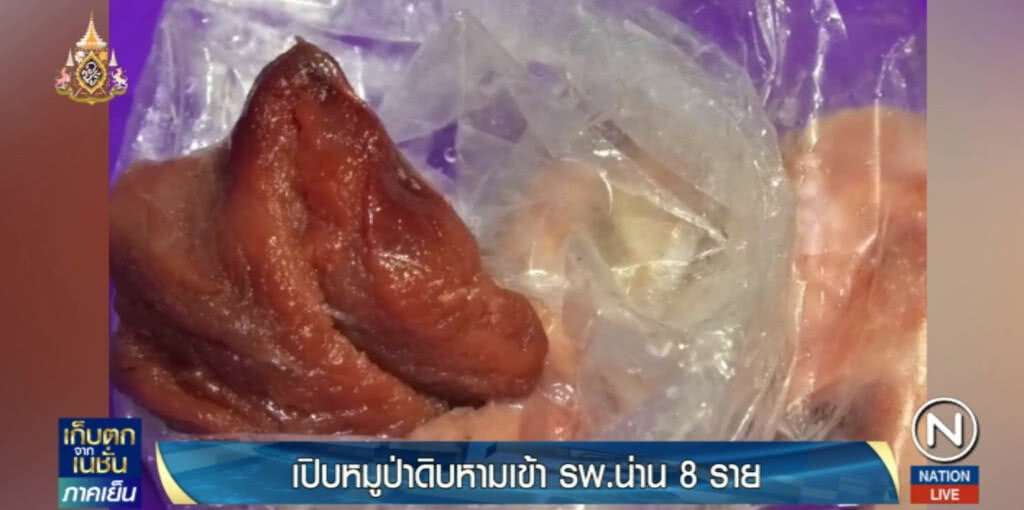 เปิบพิสดาร!....."หมูป่า" ดิบหาม 8 รายส่งโรงพยาบาล