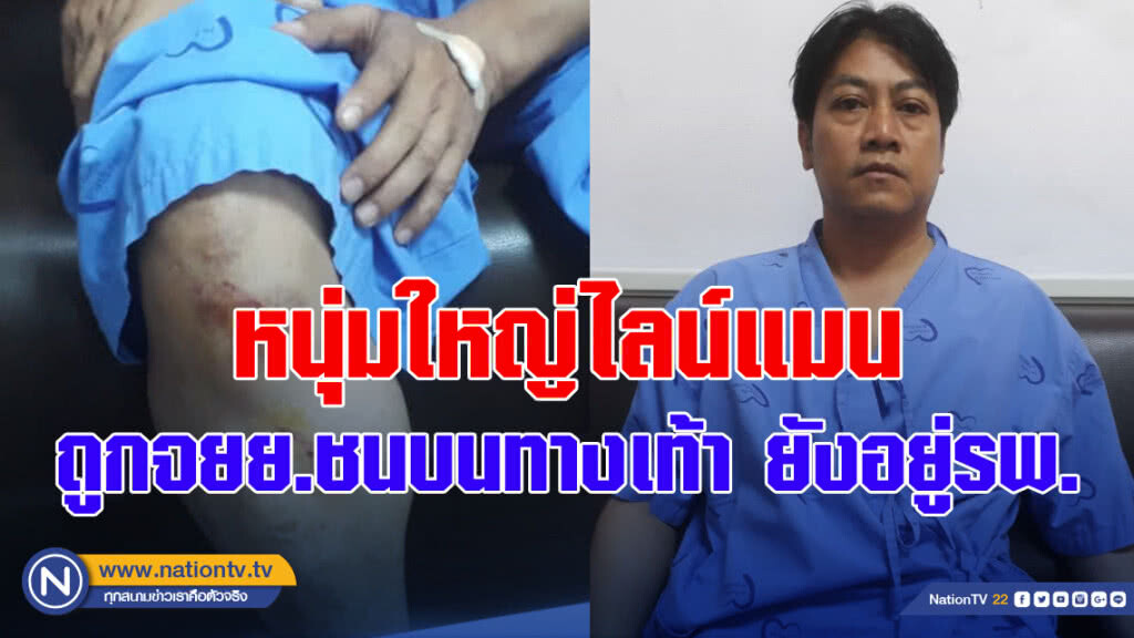 หนุ่มใหญ่ไลน์แมนถูกจยย.ชนบนทางเท้ายังรักษาตัวอยู่รพ. หนุ่มใหญ่ไลน์แมนถูกจยย.ชนบนทางเท้ายังรักษาตัวอยู่รพ.