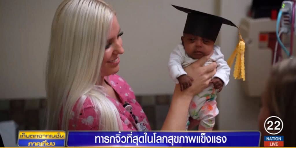 ทารกตัวเล็กที่สุดในโลก หนักเท่าลูกแอ๊ปเปิล ออกจาก รพ.แล้ว